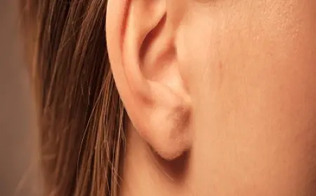 Top Surgeons for Ear Reshaping in Islamabad