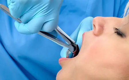 How Dentists Perform Tooth Removal: Step-by-Step Process