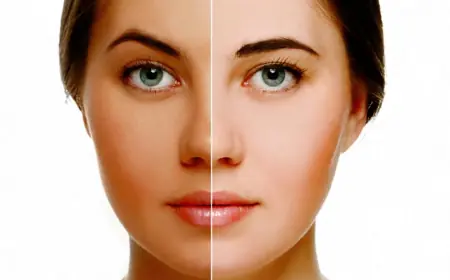 الفرق بين تصبغات الجلد والبقع الداكنة