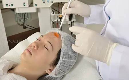 Glycolic vs. Salicylic Chemical Peels in Riyadh: Which One is Better?