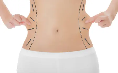 Transform Your Body: Riyadh Liposuction Insights