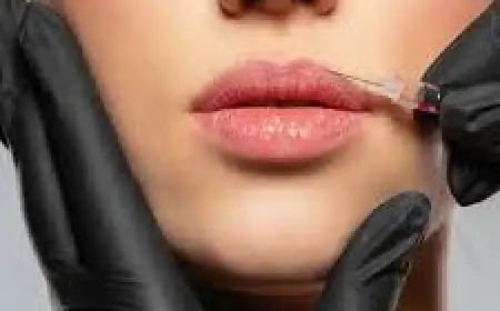 Lip Fillers Treatment in Islamabad: A Complete Guide to Fuller, Natural-Looking Lips