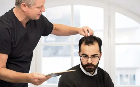 What Are The Best Hair Restoration Clinics In My Area?
