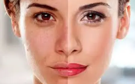 Discover Brighter Skin with Skin Whitening Treatments in Islamabad