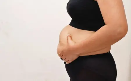 Liposuction for Back Fat: What Results Can You Expect?