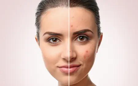 Step-by-Step: What to Expect During Your Scar Removal Procedure in Dubai