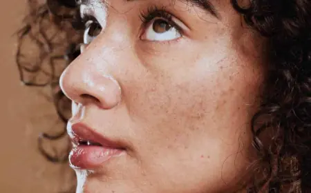 Can Dermal Pigmentation Be Removed Safely?