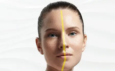 Pigmentation Treatment: How Often Should You Get Sessions