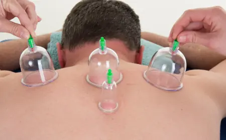 Insider Access to Best Hijama Treatment Cost in Dubai Offers