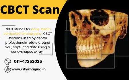 CBCT Scan Price & Finding a CBCT Scan Near Me – A Complete Guide