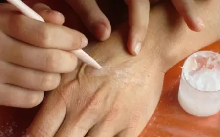 Can Natural Oils Speed Up Vitiligo Recovery? Here’s What Experts Say