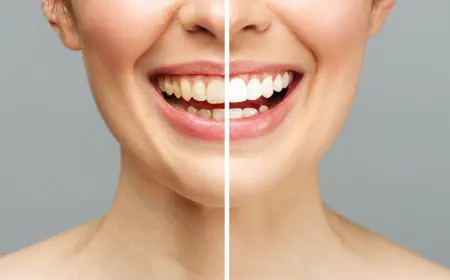 Transform Your Smile with a Leading Cosmetic Dentist in Cary NC