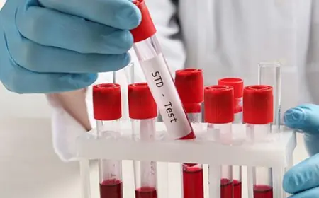 How to Choose the Best Clinic for STD Test in Dubai