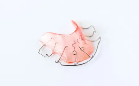 The Link Between Retainers and Gum Health