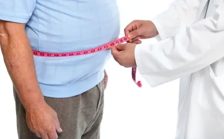 Top Reasons to Consult an Obesity Doctor Singapore Patients Trust