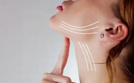 Enhance Your Side Profile with Temple Lift Fillings in Dubai