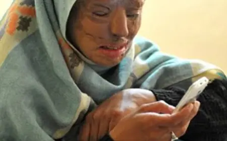 Man Who Attacked Woman With Acid Finally Confesses