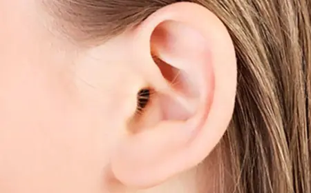 Ear Reshaping: Transform Your Ears and Facial Profile Quickly