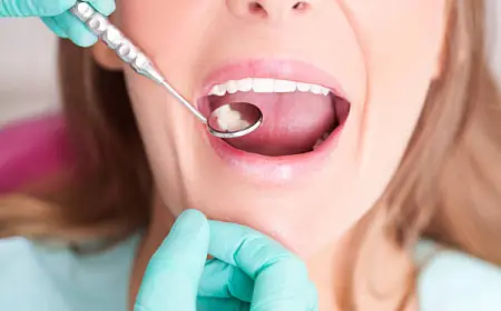 Safe and Effective Amalgam Removal in Dubai: What You Should Know