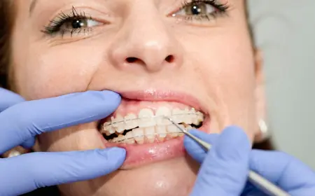 The Difference Between Pediatric Dentists and Orthodontists