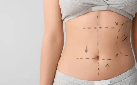 Does Best Liposuction Guarantee Flat Belly?
