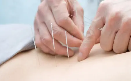 Boost Your Energy & Immunity with Acupuncture Service in Scarborough, ON