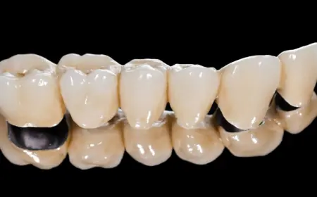 The Role of Zirconia Crowns in Smile Makeovers