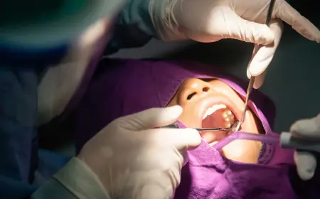 Tooth Removal Aftercare: Keeping Your Mouth Healthy