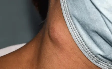 The Role of Lymph Nodes in Cancer Diagnosis and Staging