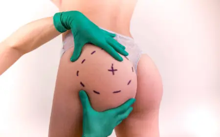 Brazilian Butt Lift in Dubai: A Path to Glamorous Curves