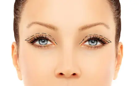 أفضل مراكز جراحة رأب الجفن في الرياض 2025