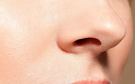 Rhinoplasty: Modern Techniques for a Flawless Look