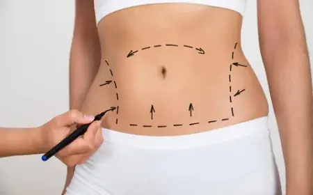 How Tummy Tuck Surgery Differs from Liposuction Explained