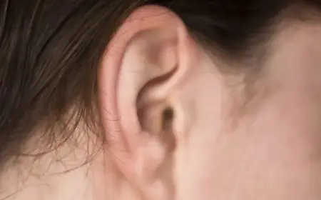 What Happens During Ear Reshaping Surgery Step-by-Step