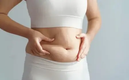 The Role of Tummy Tuck Surgery in Post-Pregnancy Transformation