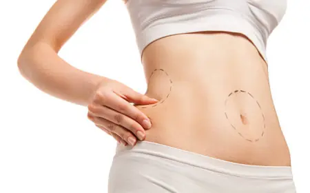 Latest Advances in Liposuction Technology Now in Riyadh