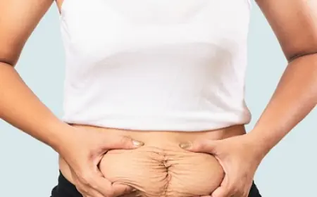 Can a Tummy Tuck Correct Stubborn Belly Fat Permanently?