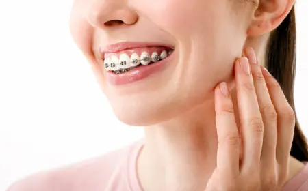 The Role of Orthodontists in Teeth Braces Treatments