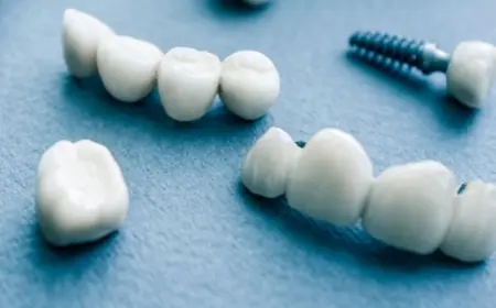 Zirconia Crowns vs. Ceramic Crowns: A Comparative Guide