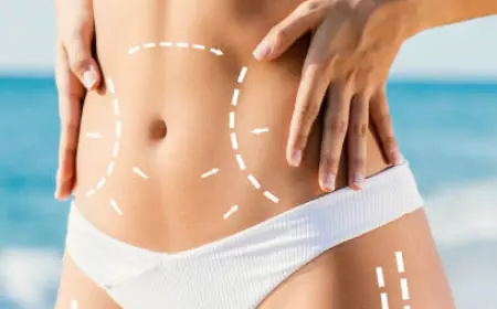 Is a Tummy Tuck in Riyadh Right for You? Complete Guide