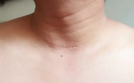 Discover Clarity with Surgical Scar Revision