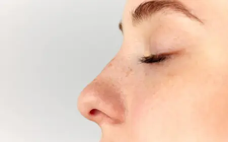 Rhinoplasty in Dubai for Men and Women: What You Should Know