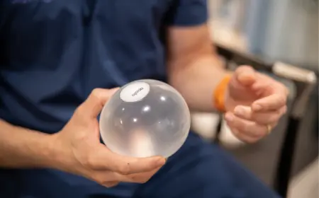 Can The Allurion Balloon Be Done More Than Once?