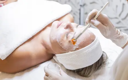 What Is a Chemical Peel? A Beginner’s Guide for Riyadh Skincare Fans