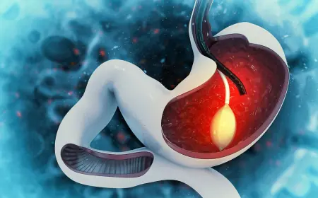 How Long Gastric Balloon Placement Lasts