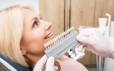 Can E-Max Veneers Stain? What You Should Know