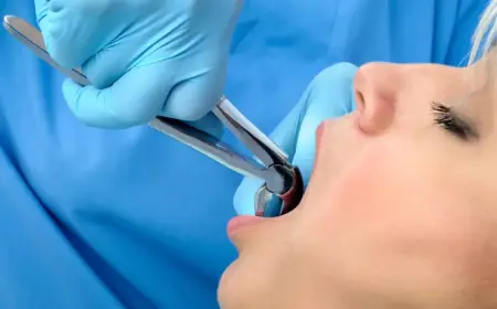 Tooth Removal and Infection Risks: What Patients Should Know