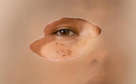 The Benefits of Eyelid Surgery in Riyadh: Enhancing Appearance and Confidence