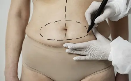 Tummy Tuck Surgery in Riyadh: Before and After Photos to Inspire You