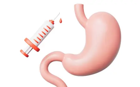 من يستفيد أكثر من بوتوكس المعدة؟